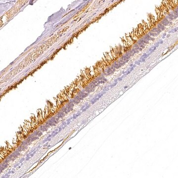 Anty-GNAT1 Prestige Antibodies&#174; Powered by Atlas Antibodies, affinity isolated antibody