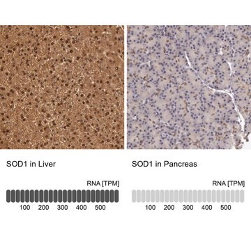 抗SOD1 ウサギ宿主抗体 Prestige Antibodies&#174; Powered by Atlas Antibodies, affinity isolated antibody, buffered aqueous glycerol solution