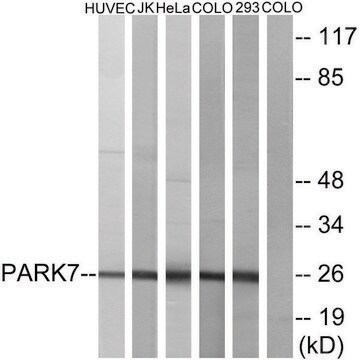 抗PARK7抗体 ウサギ宿主抗体 affinity isolated antibody