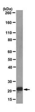 Anti-p21WAF1 Antibody, clone EA10 clone EA10, from mouse