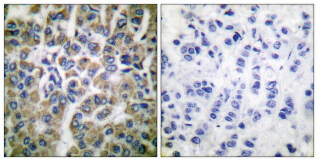 抗HSP10抗体 ウサギ宿主抗体 affinity isolated antibody