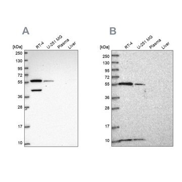 Anti-NUP50 antibody produced in rabbit Prestige Antibodies&#174; Powered by Atlas Antibodies, affinity isolated antibody