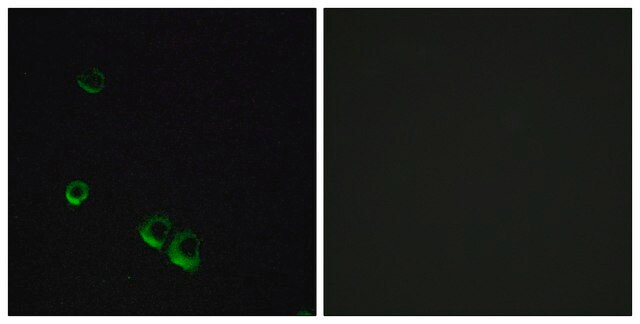 Anti-AVPR2 antibody produced in rabbit affinity isolated antibody