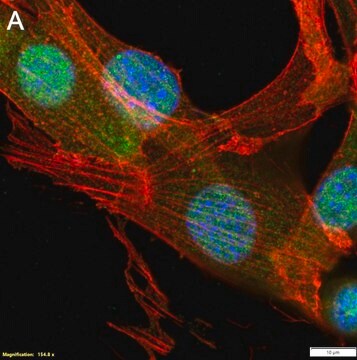 Anti-S100A4 Antibody, clone 1G2 ZooMAb&#174; Rabbit Monoclonal recombinant, expressed in HEK 293 cells