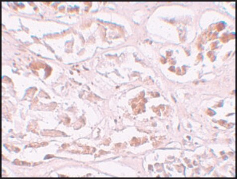 抗ALKBH2 ウサギ宿主抗体 affinity isolated antibody, buffered aqueous solution