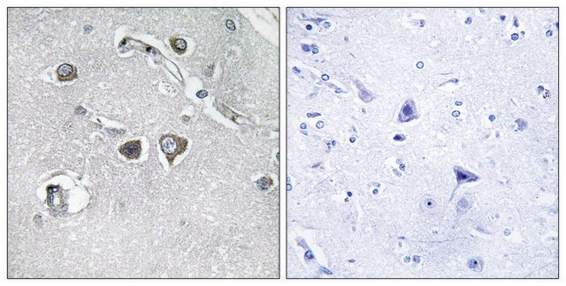 Anti-Collagen XI &#945;2 antibody produced in rabbit affinity isolated antibody