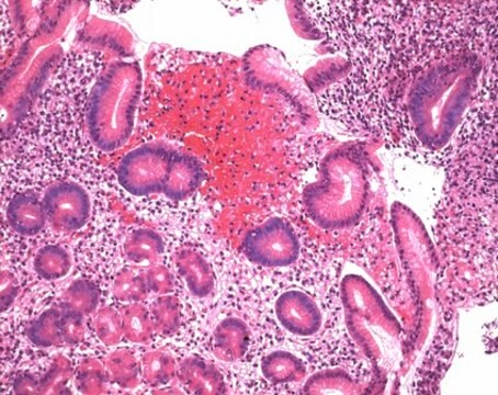 Disolución hemalum de Mayer for microscopy