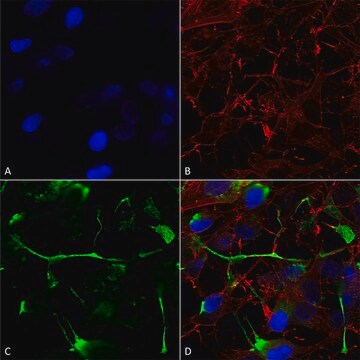 单克隆抗Pink1 小鼠抗 clone S4-15, purified immunoglobulin