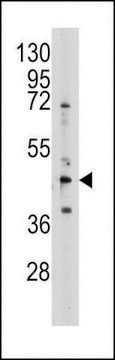 ANTI-S ADENOSYLHOMOCYSTEINE HYDROLASE (ACHY)(N-TERMINAL) antibody produced in rabbit purified immunoglobulin, buffered aqueous solution