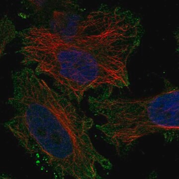 Anti-Kcnv1 Antibody Produced In Rabbit Prestige Antibodies&#174; Powered by Atlas Antibodies, affinity isolated antibody, buffered aqueous glycerol solution