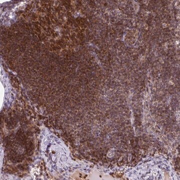 Anti-PRKCH antibody produced in rabbit Prestige Antibodies&#174; Powered by Atlas Antibodies, affinity isolated antibody, buffered aqueous glycerol solution