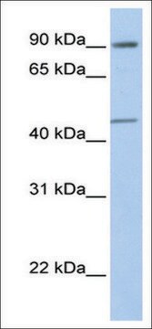 Anti-GTF2H4 antibody produced in rabbit affinity isolated antibody