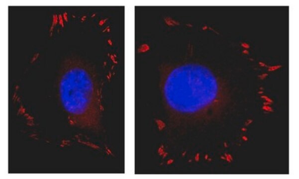 Anti-FAK Antibody, clone 4.47, Alexa Fluor&#8482; 555 conjugate clone 4.47, Upstate&#174;, from mouse