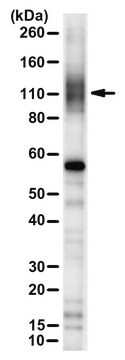 Anti-ANO6/TMEM16F