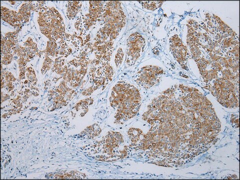 Anti-FGF6 affinity isolated antibody