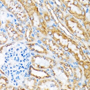 Anti-MSP/MST1 antibody produced in rabbit