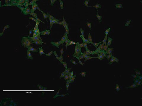 VERO Cell Line NOTE: Both the cell line and DNA from the cell line may be available for this product. Please choose -1VL or VIAL for cells, or -DNA-5UG for DNA, 84113001, African green monkey kidney, Fibroblast-like