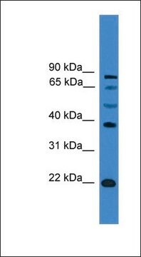 Anti-ASCL2 antibody produced in rabbit affinity isolated antibody