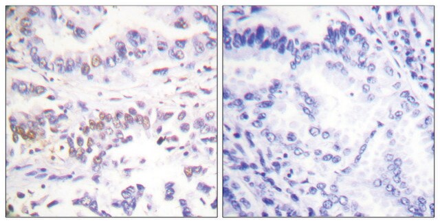 Anti-XRCC3 antibody produced in rabbit affinity isolated antibody