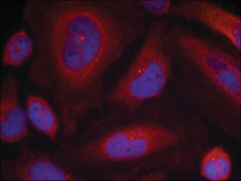 Anti-phospho-SYT1 (pSer309) antibody produced in rabbit affinity isolated antibody