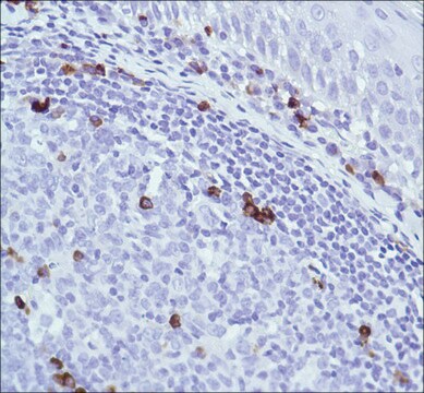 Anti-J-CHAIN antibody, Rabbit monoclonal clone SP105, recombinant, expressed in proprietary host, affinity isolated antibody