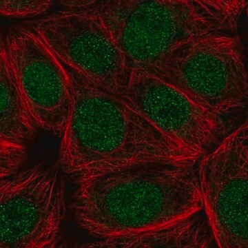 Anti-CDC73 antibody produced in rabbit Prestige Antibodies&#174; Powered by Atlas Antibodies, affinity isolated antibody