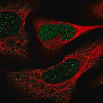 Anti-DERA antibody produced in rabbit Prestige Antibodies&#174; Powered by Atlas Antibodies, affinity isolated antibody