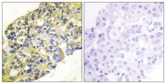 抗-PI3-激酶 p85-&#945; 兔抗 affinity isolated antibody