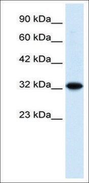 Anti-ZBTB32 antibody produced in rabbit affinity isolated antibody