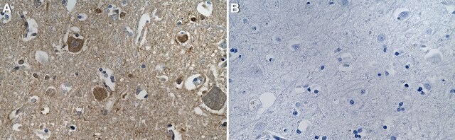 Anti-PROKR2 Antibody, clone 1J6 ZooMAb&#174; Rabbit Monoclonal recombinant, expressed in HEK 293 cells