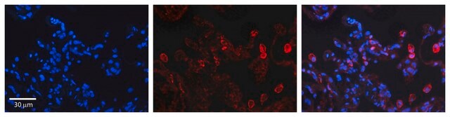 抗DEGS1 ウサギ宿主抗体 affinity isolated antibody