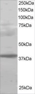 抗MEL18/PCGF2抗体 ヤギ宿主抗体 affinity isolated antibody, buffered aqueous solution