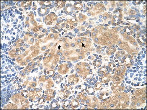 Anti-TSPAN5 affinity isolated antibody