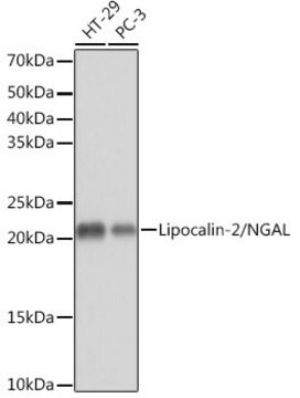 Anti-Lipocalin-2/NGAL antibody produced in rabbit