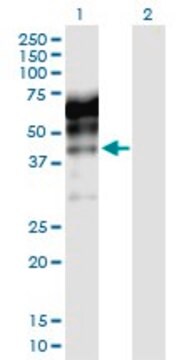 抗KNG1抗体 ウサギ宿主抗体 purified immunoglobulin, buffered aqueous solution