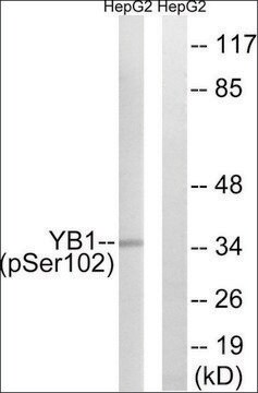 Anti-phospho-YB1 (pSer102) antibody produced in rabbit affinity isolated antibody