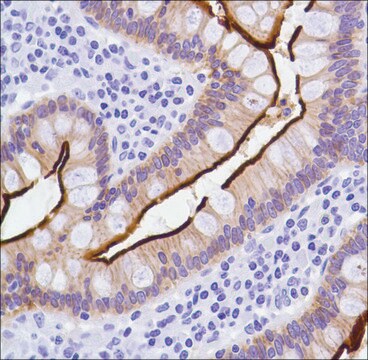 Anti-Villin antibody, Rabbit monoclonal recombinant, expressed in proprietary host, clone SP145, affinity isolated antibody