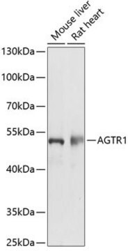 Anti-AGTR1 antibody produced in rabbit