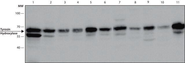 Anti-Tyrosine Hydroxylase antibody, Mouse monoclonal clone TH-16, purified from hybridoma cell culture