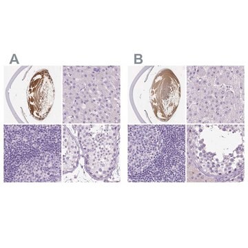 Anty-LGSN Prestige Antibodies&#174; Powered by Atlas Antibodies, affinity isolated antibody