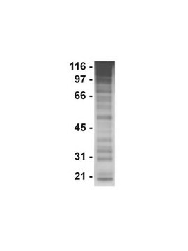 Anticorpo anti-fosfotirosina, clone PY20 clone PY20, Upstate&#174;, from mouse