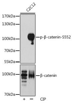 Anti-Phospho-beta Catenin-S552 antibody produced in rabbit