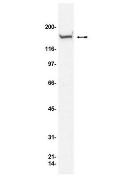 Anticorpo anti-Rad50, clone 13B3/2C6 clone 13B3/2C6, Upstate&#174;, from mouse