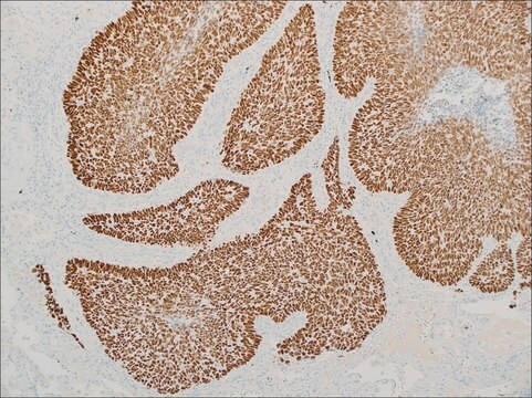 p53 (EP9) Rabbit Monoclonal Primary Antibody