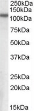 Anti-MP100/NPEPPS antibody produced in goat affinity isolated antibody, buffered aqueous solution