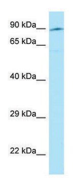 Anti-SEMA3E (C-terminal) antibody produced in rabbit affinity isolated antibody