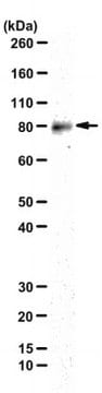 Anti-PADI2/PAD2 Antibody, clone DN2