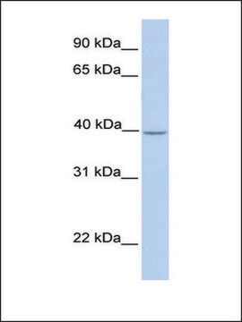 Anti-SAMSN1 antibody produced in rabbit affinity isolated antibody