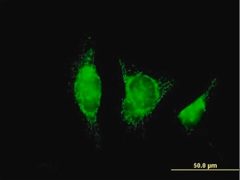 Anti-ADH1B antibody produced in mouse purified immunoglobulin, buffered aqueous solution