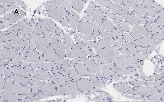 抗デスミン抗体 クローン1H16 ZooMAb&#174; ウサギ・モノクローナル recombinant, expressed in HEK 293 cells